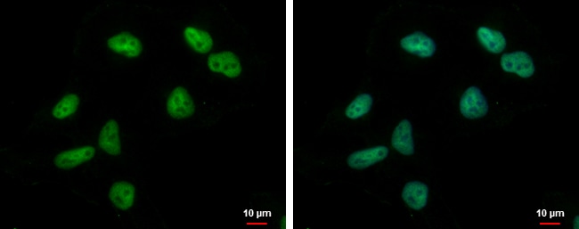 100uL Polyclonal antibody, ZNF76, host r