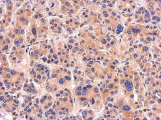 100uL Polyclonal antibody, NTAN1, host r