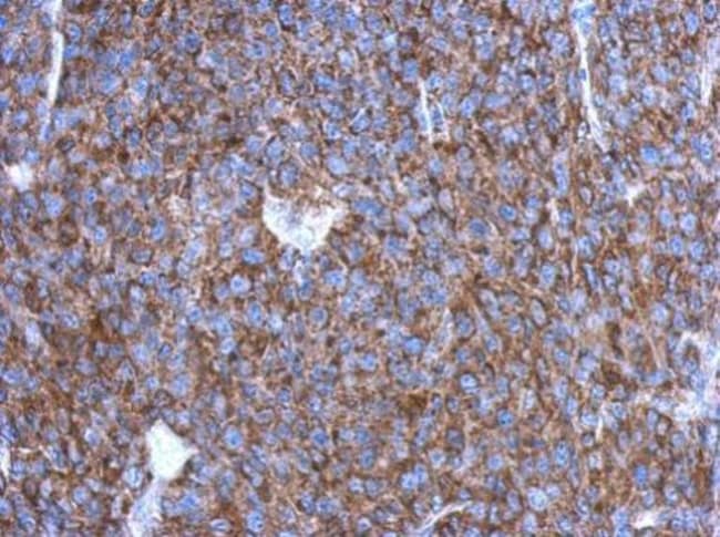 100uL Polyclonal antibody, OVCA2, host r