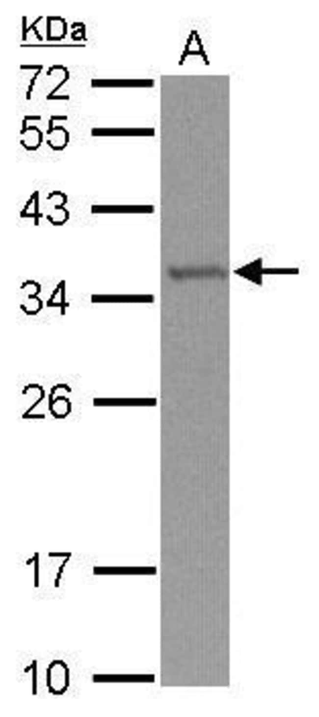 100uL Polyclonal antibody, TRM61, host r