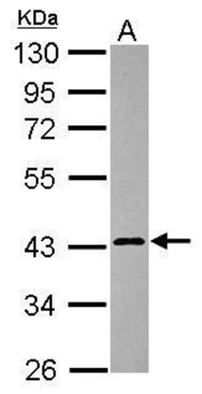 100uL Polyclonal antibody, calreticulin