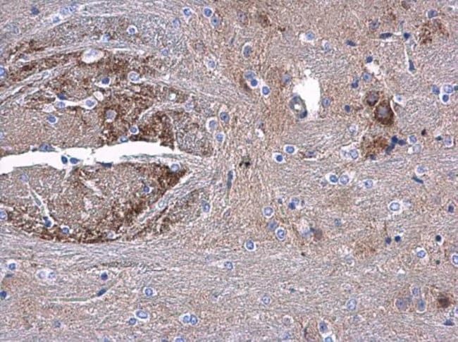 100uL Polyclonal antibody, AAMP, host ra