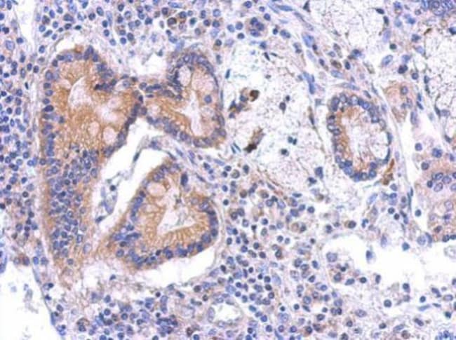 100uL Polyclonal antibody, BCKDK, host r