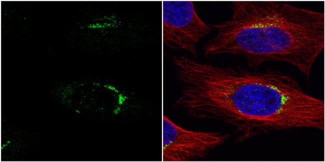100uL Polyclonal antibody, VPS33A, host