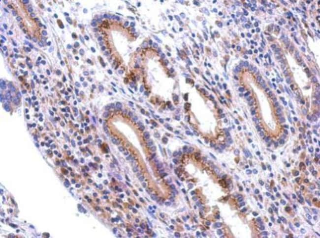 100uL Polyclonal antibody, GALNT7, host