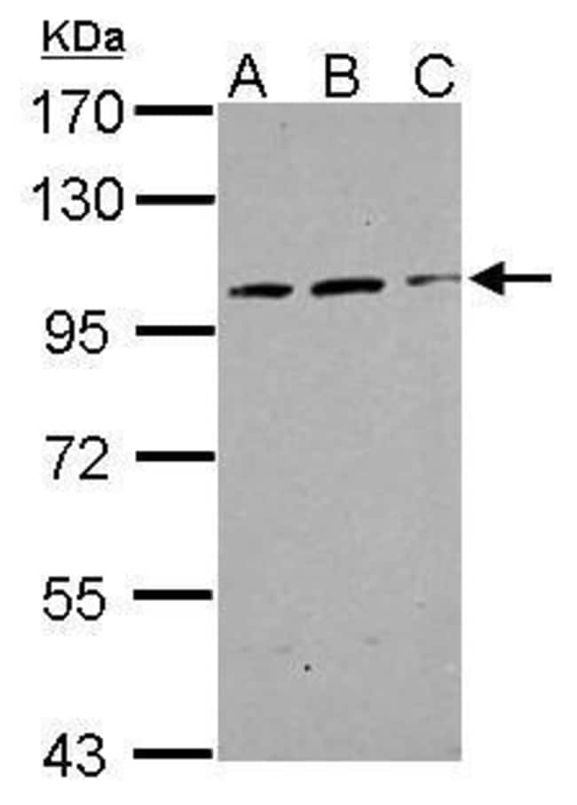 100uL Polyclonal antibody, TRAK2, host r
