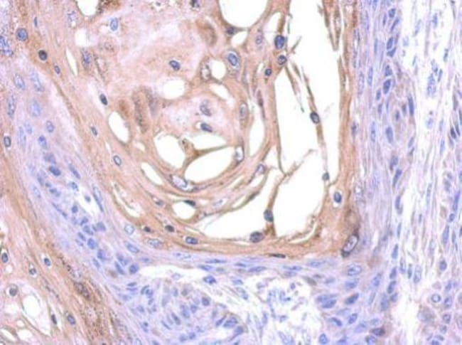 100uL Polyclonal antibody, SNX18, host r