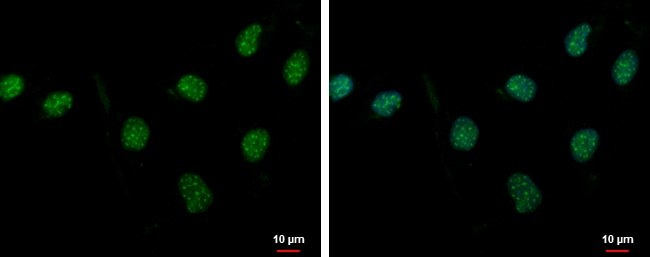 100uL Polyclonal antibody, PASD1, host r