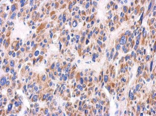 100uL Polyclonal antibody, KIR2DS2, host