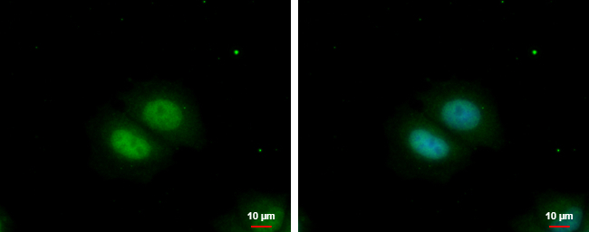 100uL Polyclonal antibody, RBM22, host r