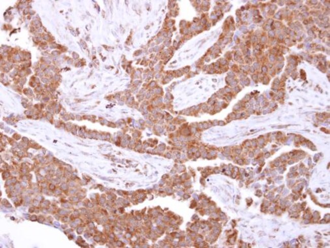 ANTI-GLUTATHIONE S-TRANSFERASE KAPPA 1