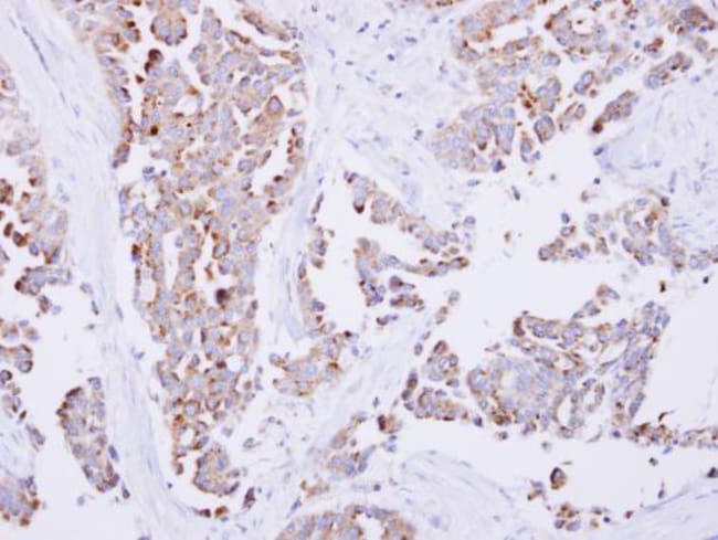 100uL Polyclonal antibody, SARS2, host r