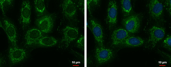 100uL Polyclonal antibody, SARS2, host r