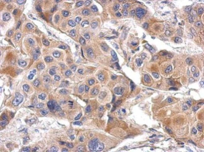100uL Polyclonal antibody, LILRA4, host