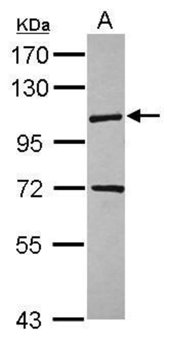 100uL Polyclonal antibody, KIF18A, host