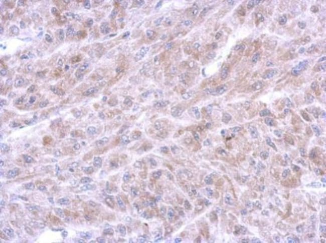 100uL Polyclonal antibody, annexin A8, h