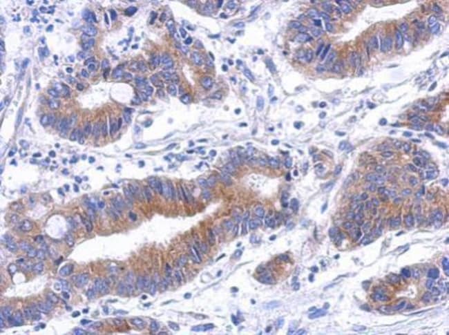100uL Polyclonal antibody, annexin A8, h