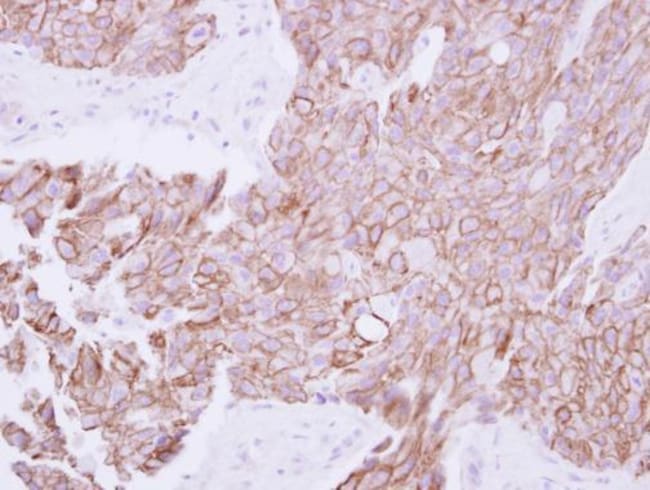 100uL Polyclonal antibody, TMPRSS11B, ho
