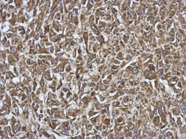 100uL Polyclonal antibody, SMYD1, host r