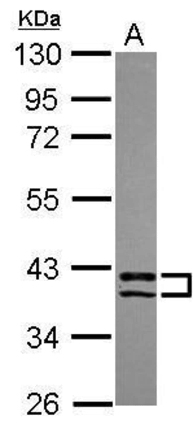 100uL Polyclonal antibody, PDLIM2, host