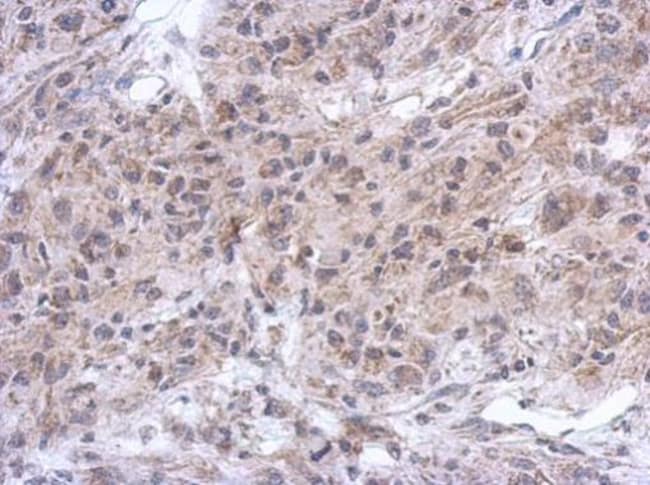 100uL Polyclonal antibody, Spinesin, hos