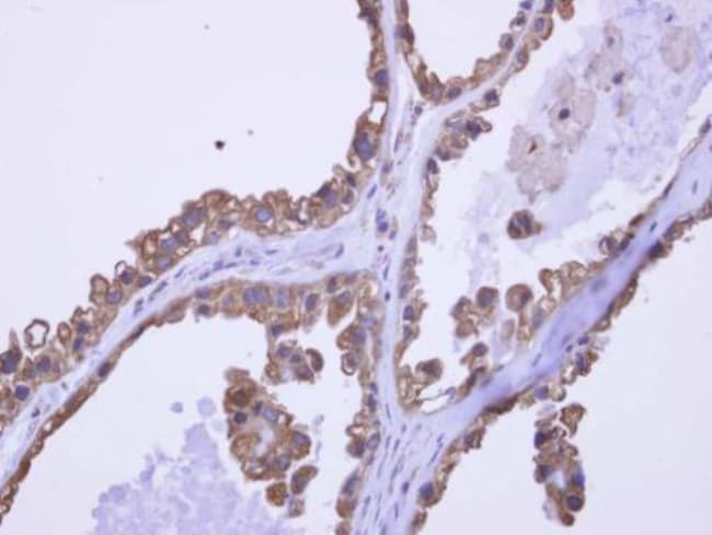 100uL Polyclonal antibody, DDX43, host r