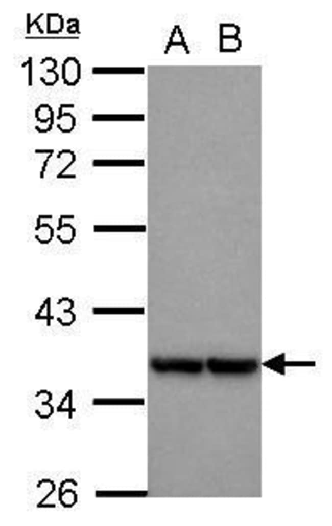 100uL Polyclonal antibody, MRPL3, host r