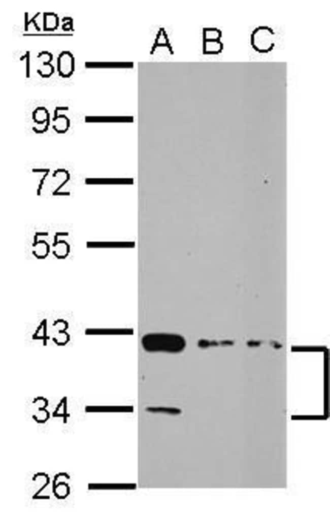 100uL Polyclonal antibody, PDLIM3, host