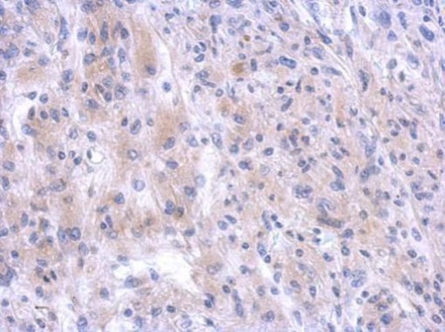 100uL Polyclonal antibody, PGBD1, host r