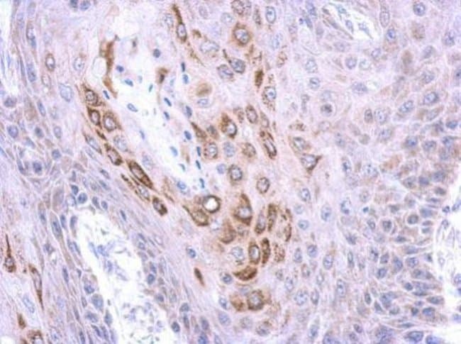 100uL Polyclonal antibody, triM4/ RNF87,