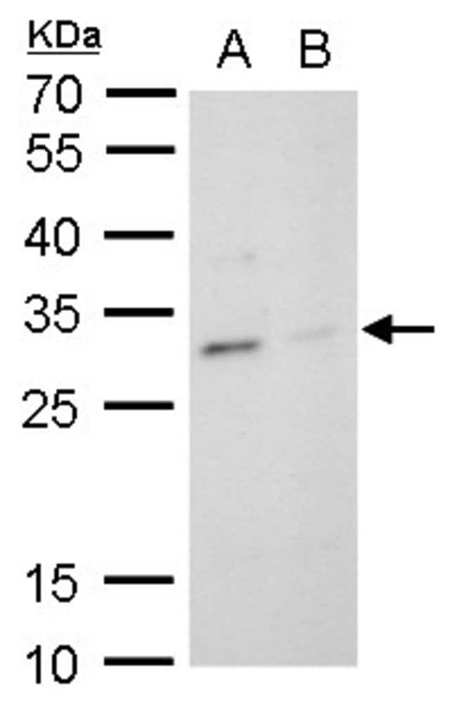 100uL Polyclonal antibody, TPPP, host ra