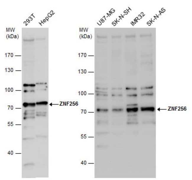 100uL Polyclonal antibody, ZNF256, host