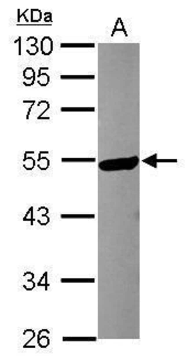 100uL Polyclonal antibody, KATNA1, host