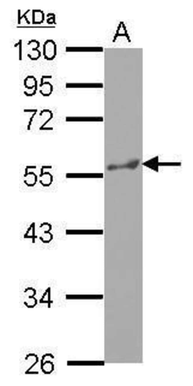 100uL Polyclonal antibody, KATNA1, host