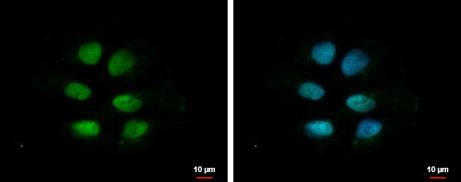 100uL Polyclonal antibody, ZNF571, host