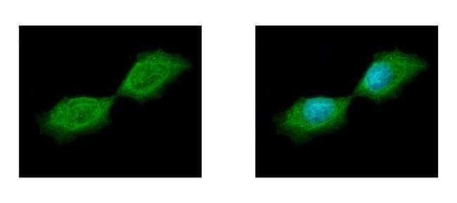 100uL Polyclonal antibody, SEPT12, host