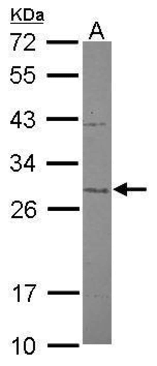 100uL Polyclonal antibody, MTIF3, host r
