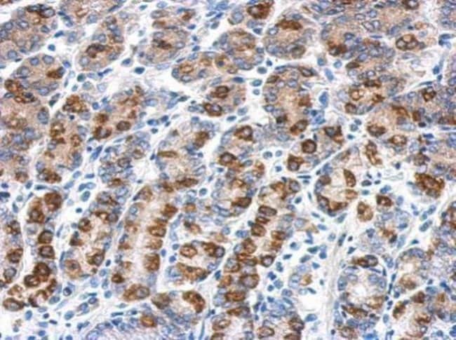100uL Polyclonal antibody, CYB5R1, host