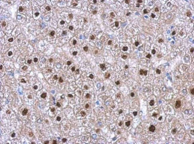 100uL Polyclonal antibody, RNF92, host r