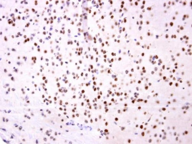 100uL Polyclonal antibody, OTP, host rab