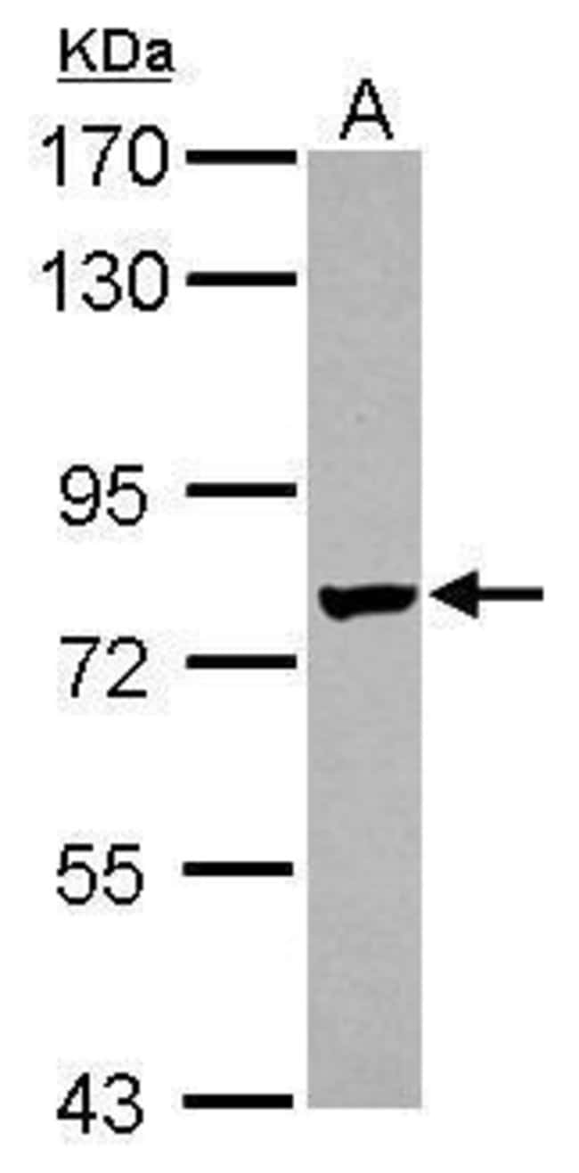 100uL Polyclonal antibody, netrin G1 lig
