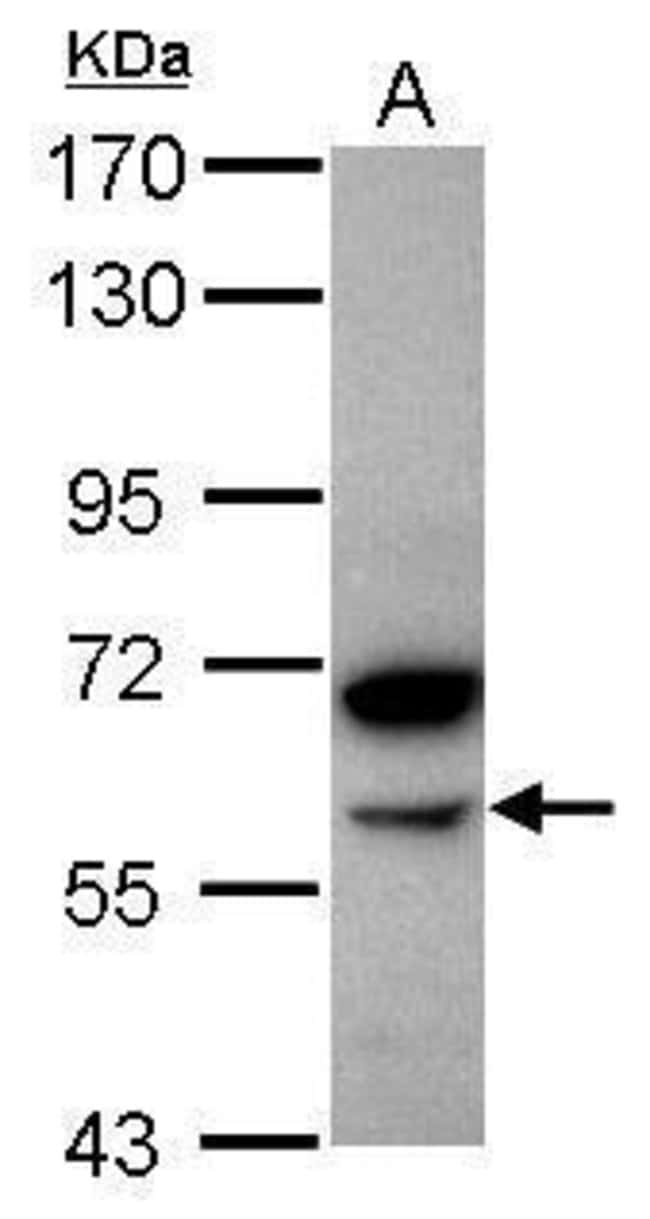 ANTI-ALPHA AMYLASE 2B (PANCREATIC)