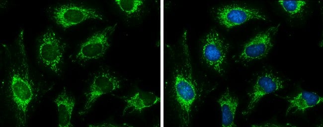 ANTI-PYRUVATE DEHYDROGENASE E1 BETA SUBU