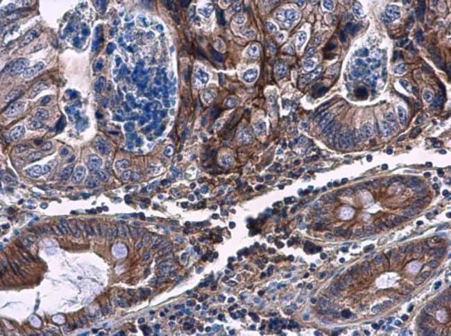 100uL Polyclonal antibody, CHST4, host r