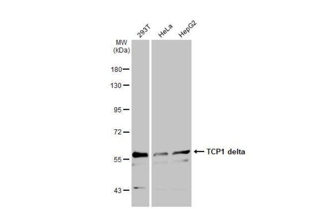 100uL Polyclonal antibody, TCP1 delta, h