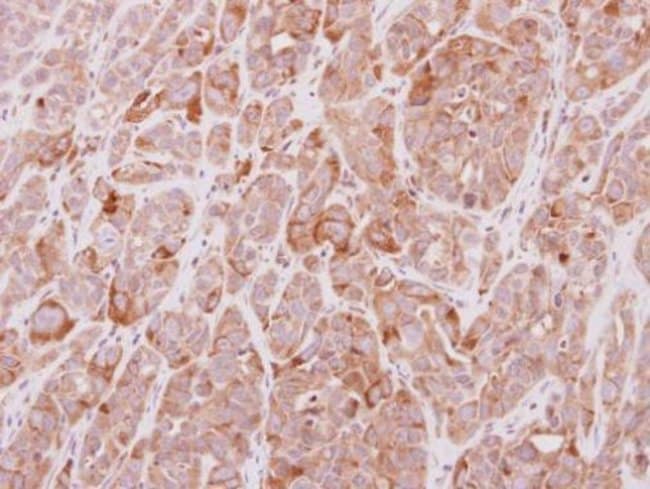 100uL Polyclonal antibody, MGAT4A, host