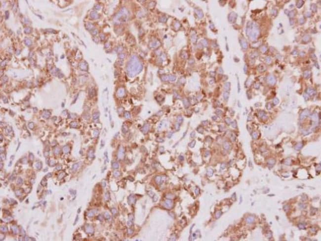 100uL Polyclonal antibody, PCYOX1, host