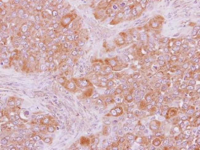 100uL Polyclonal antibody, ARHGAP15, hos