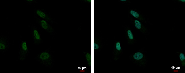 100uL Polyclonal antibody, ZNF587, host