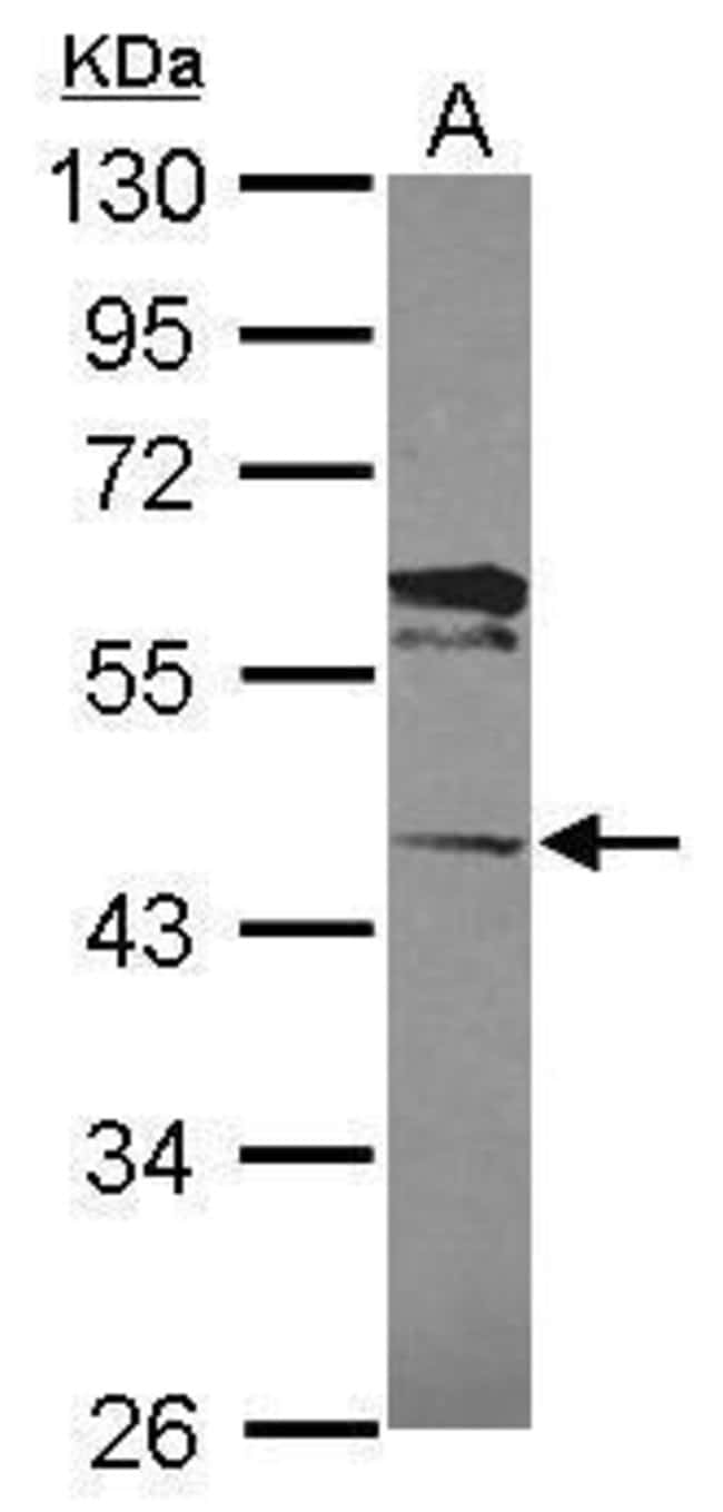 100uL Polyclonal antibody, C13orf31, hos